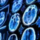 Revolūcija Medicīnā: Jauns AI Rīks Prognozē Individuālo Mirstības Risku un Novecošanās Ātrumu