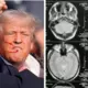 Trampa dīvainais lūgums slimnīcā: IQ tests pēc atentāta satricina mediķus