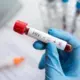 Vēsturisks Lēmums: Spēkā Stājas Pirmais Notiesājošais Spriedums par Apzinātu Inficēšanu ar HIV Latvijā