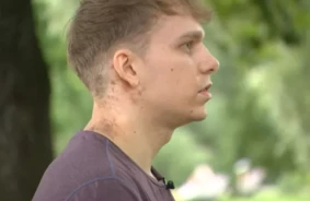 Aizkustinošs brīnums: Edgars Pujāts izdzīvo pēc zibens trieciena pie Māras dīķa