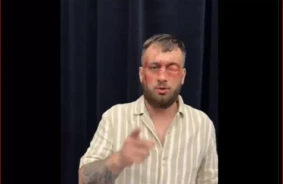 Kristapa Zuša asiņainā seja, kas šokēja Latviju: teātris, realitāte un publiskā tēla meistarklase