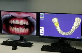 Matiem glābšanas misija: Londonas zinātnieku revolucionārā zobu pasta atjauno bojātu emalju