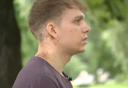 Aizkustinošs brīnums: Edgars Pujāts izdzīvo pēc zibens trieciena pie Māras dīķa