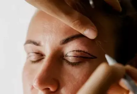 Estētikai – 1500 eiro, medicīnai – bez maksas: vai un kad valsts segs plakstiņu operāciju?