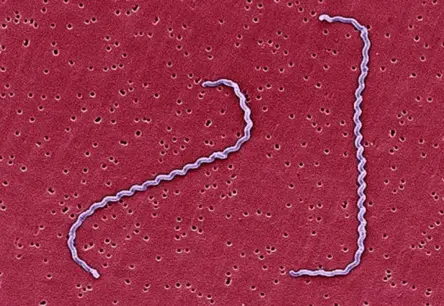 Latviju pārņēmis bīstamas infekcijas uzliesmojums: Leptospiroze prasa dzīvības un izplatās strauji