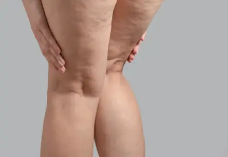 Novecošanās negaidītie uzplaiksnījumi: Zinātnieki atklāj divus kritiskus vecumus organismā