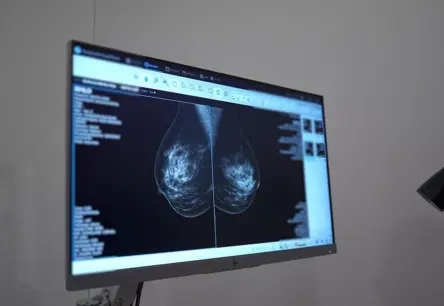 Revolucionārs ģenētiskais tests krūts vēzim: mazāk ķīmijterapijas, vairāk cerību Latvijas sievietēm