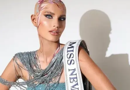Skaistums nav vien matos: "Mis Nevada" Mērija Siklere uz "Mis ASV" skatuves kāpj bez parūkas, iedvesmojot miljonus