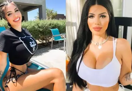 Šovu zvaigznes Larisas dos Santosas Limas rūgtā atklāsme: kā mākslīgais skaistums kļuva par smagu nastu