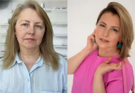 Stila pārvērtības: Kā Olgas smaids atklāja jaunu pašapziņu