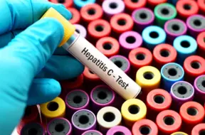 C hepatīts Latvijā: Nenovērtētais risks un ceļš uz izārstēšanu