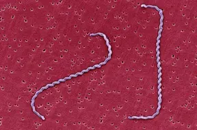 Latviju skāris bīstamas leptospirozes uzliesmojums: trīs dzīvības zaudētas