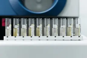 Polio vīruss atklāts Vācijas notekūdeņos: kāpēc satraukums ir pamatots, neskatoties uz zemo risku