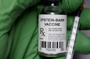 Stenfordas pētnieki: Izplatīts vīruss varētu būt lupusa galvenais izraisītājs